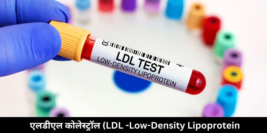 एलडीएल कोलेस्ट्रॉल (LDL-Low-Density Lipoprotein)