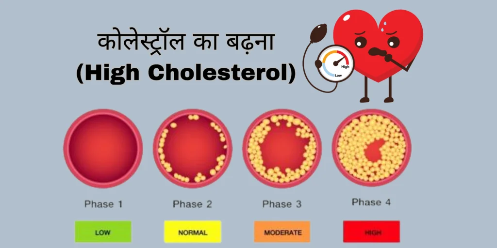 कोलेस्ट्रॉल का बढ़ना (High Cholesterol)